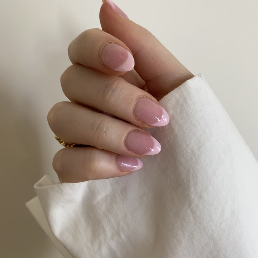 Gel-Modellage — Beispiel